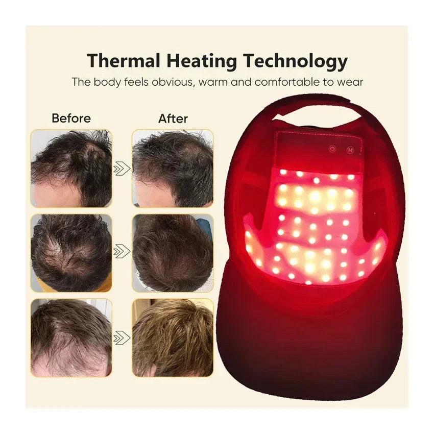 Red Light Therapy For Hair